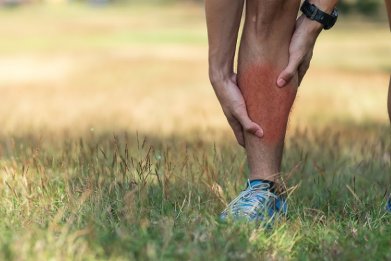 Everything You Need To Know About Shin Splints